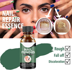 Fast Nail Fungus Remover