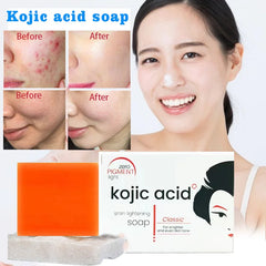 Kojic Acid Soap For Face & Body Whitening & Moisturizing
