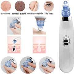 DermaSuction Cell Operated Blackhead Remover with 4 Suction Heads
