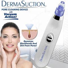 DermaSuction Cell Operated Blackhead Remover with 4 Suction Heads